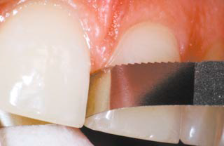 Алмазная полоска NTI с зубчатым краем